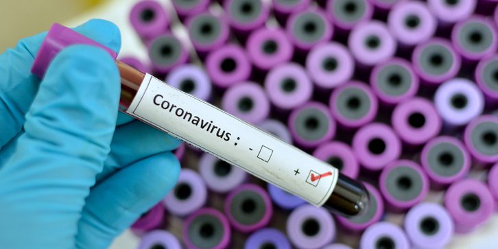 Coronavirus positive Coronavirus ciudad jardín