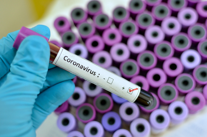 Coronavirus positive Coronavirus ciudad jardín
