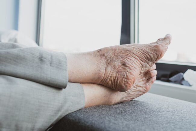 Podología geriátrica -Ciudad Jardín, residencia de mayores en Cáceres